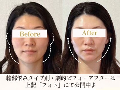 サロンキャン(Salon.CAN)の写真