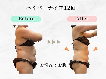 ウェリナ平和堂長久手院/小顔矯正/骨盤矯正/痩身/整体