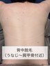 【背中の産毛に!/夏前の準備◎】背中脱毛(背中上部まで) 光脱毛 ¥4,800