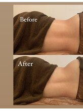 マルレ アイサロン 三軒茶屋(MARLE eyesalon)/【ボディメイク】綺麗なくびれを