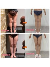 サンタイ(santai.)/筋膜リリース