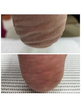 ドクターネイル爪革命 十条店/角質ケア