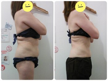 鈴木整体院 仙台泉院/小顔造顔/骨盤矯正/痩身整体