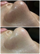 リエット(Lieto)/