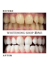 ホワイトニングショップ 葛西店/ホワイトニング専門店