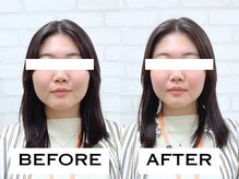 ビハリスト 新宿マルイ本館/むくみがとれて輪郭がすっきり！