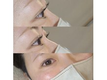 クローバーナチュレ(clover nature)の雰囲気（Lashliftでどの角度から見ても美しいまつ毛）