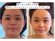 貴女のお悩みを「自信」に変える◎小顔ならお任せください！三島