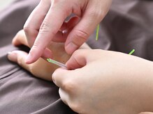 鍼灸が初めての方でもお気軽に施術を受けることができます◎