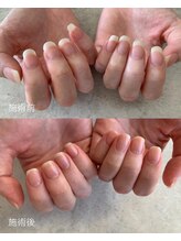イル(iLL)/Nail care &nbsp;ネイルケア