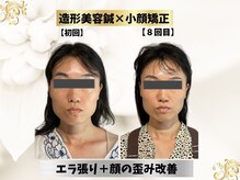 エモシオン トウキョウ(EMOTION TOKYO)/造形フェイス