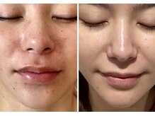 ペリドット(Peridot)