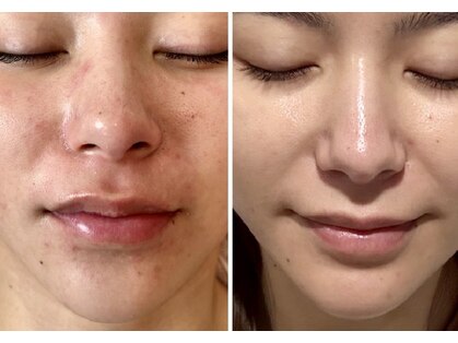 ペリドット(Peridot)の写真