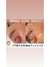 ちゅるんと卵肌《産毛Wax+小顔ピーチ》たるみ/くすみ/ざらつき/角質¥14000