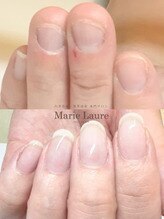 マリーロール 梅田店(Marie Laure)/自爪育成/深爪矯正/ネイルケア