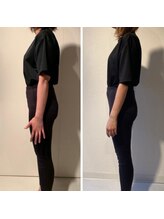 エスアップ 麻布十番店(THE S-UP)/施術前後写真