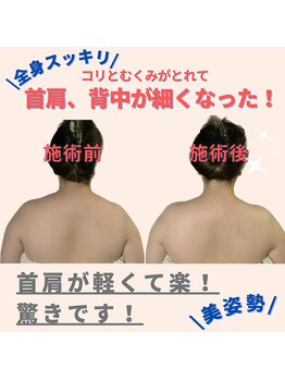 ミトラ(MITRA)/首肩こり、目の疲れスッキリ解消