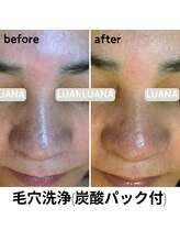 ルアナ 北谷店/毛穴洗浄毛穴ケア 《沖縄/北谷》