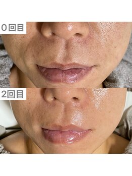 ユイット ルッカ(Huit Lucca)/アクアダーマ