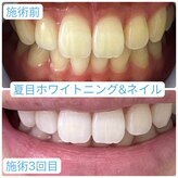 夏目ホワイトニングアンドネイル(夏目WHITENING＆NAIL)