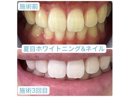 夏目ホワイトニングアンドネイル(夏目WHITENING＆NAIL)の写真