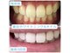 夏目ホワイトニングアンドネイル(夏目WHITENING＆NAIL)の写真