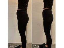 ニーティー(niti)の雰囲気（筋肉から強化するため施術していない周りの部位も痩せていきます）