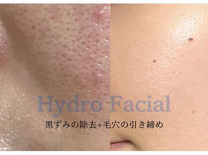 リンクス トウキョウサロン(Lynx Tokyo salon)の写真