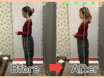 かぎとり接骨院/お悩みに寄り添った施術を提案!