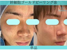 リメイククリニカルビューティー(Remake clinical beauty)/