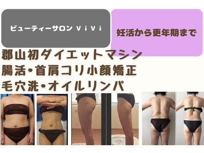 ヴィヴィ(ViVi)の写真
