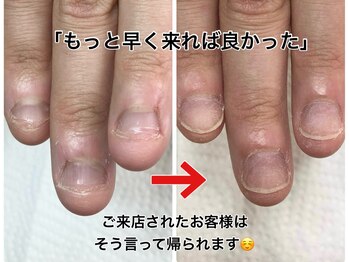 レアムネイル(Leam nail)/ネイルサロンに行っても大丈夫？