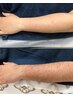 【ワックス脱毛】両腕