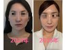 《5周年記念》上半身背面マッサージ＆人気No.1小顔矯正スペシャル ￥13200