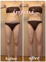 アンフィニ(infini)/短期集中全身10回コース（3ヶ月)