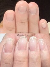 マリーロール 梅田店(Marie Laure)/自爪育成/深爪矯正/ネイルケア