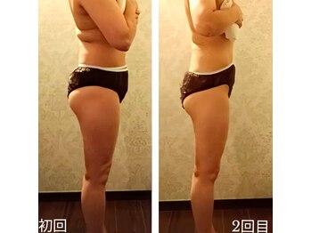 バービーホリック(barbie holic)/１３０コース　初回と２回目比較