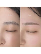 アトリーチェ(ATTRICE)/眉毛ワックス＋額ワックス