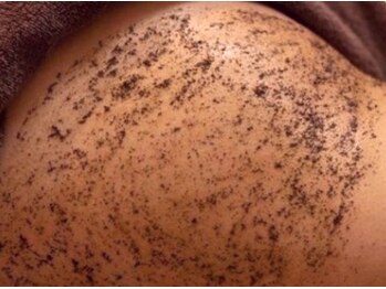 マシェ バイ マユ(Mache by Mayu)/黒ずみ・ブツブツのおしりも！