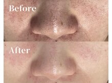 ビップフィール(vip feell)/お肌のトーンアップにも効果的★