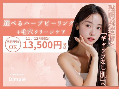 ディンプル(Dimple)の写真