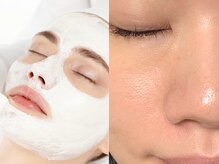 リアルナ(REALUNA)