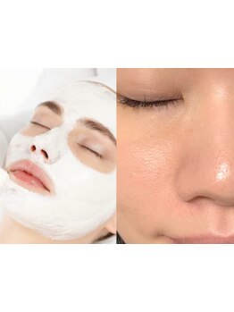 毛穴ケアをしたい