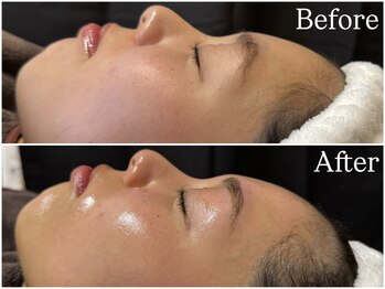 エクランプラス(Ecran+)/ＦaceＷax