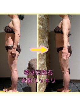 サンタイ(santai.)/specialバリニーズ