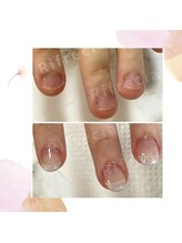 リフレシア(Rifrecia)/長さを出して見た目を変えます