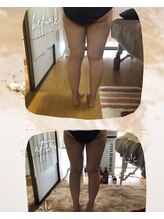 ナナラ(nanala)/脚スッキリコース！