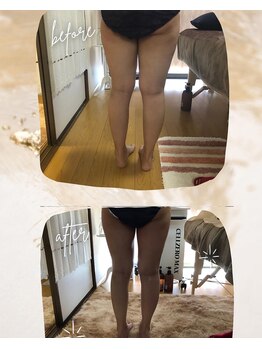 ナナラ(nanala)/脚スッキリコース!