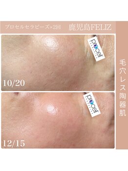 フェリス(FELIZ)/お肌プロセルセラピーズ