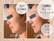 セルベッラ(cerbella)